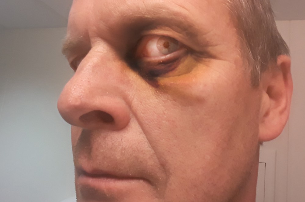 jeg_vet_hvem_du_er_tommetanker