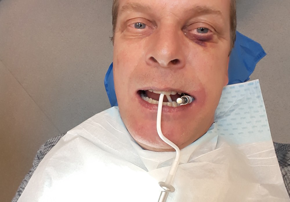 tannlege_tommetanker